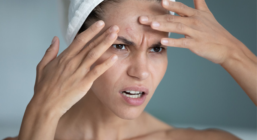How Does Stress Affect Your Skin_ Tips to Combat Stress-Induced Skin Issues